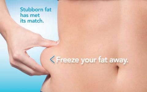 Hips treatment Watford From Lipo Sculpt