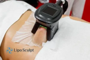 Are The Results From Aqualyx Permanent? 4 Compare Aqualyx Watford to other fat reduction treatments.