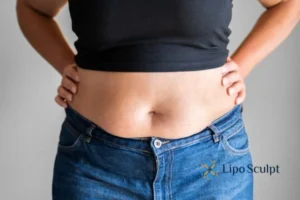 Bidding Farewell to Muffin Tops with Aqualyx Fat Injections 2 Do you wish you could reduce your muffin top Watford With Aqualy fat dissolving injections you can!